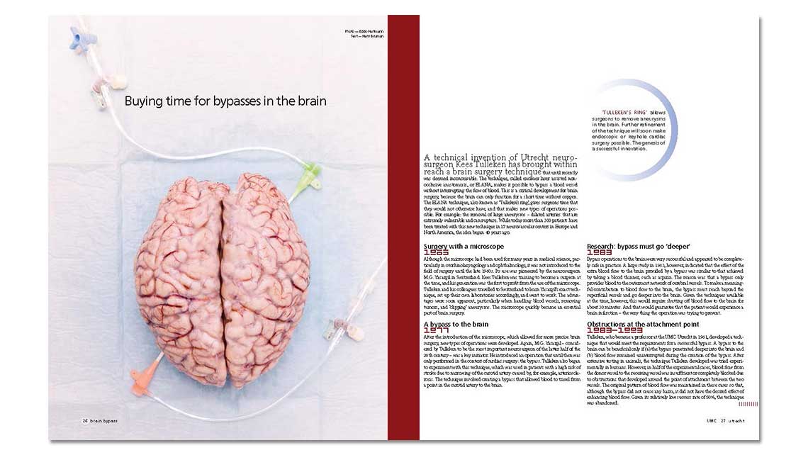 article: brain bypass