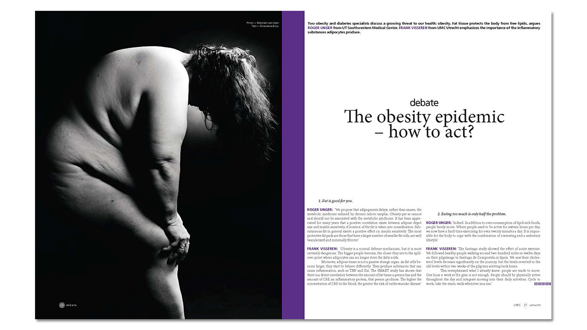 article: obesity